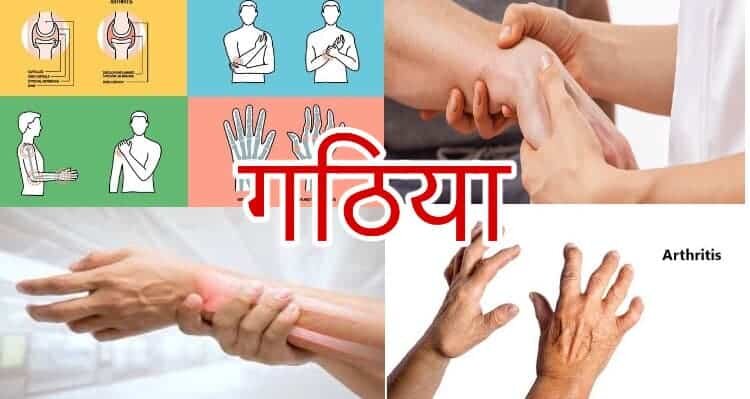 arthritis in hindi