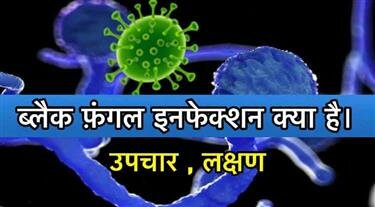 ब्लैक फंगल इनफेक्शन क्या है | What is Black Fungal Infection in Hindi (Mucormycosis)
